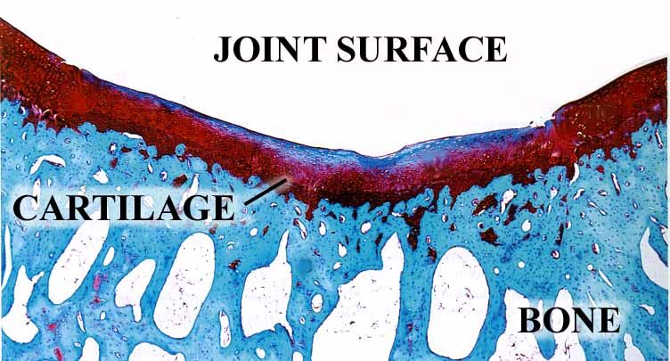 Cartilage Photomicrograph