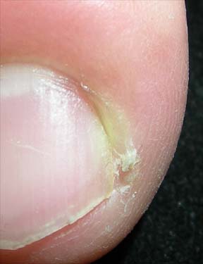 Close-up of the fingertip