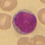 lymphocyte