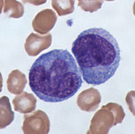 monocyte