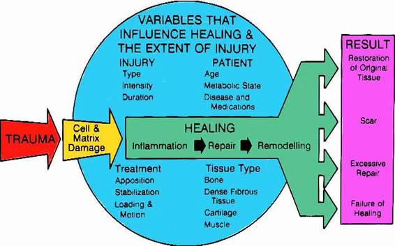 Fracture Variables