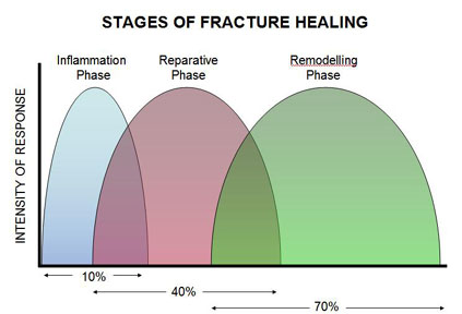 Stages of Fracture Healing